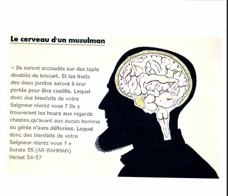 Cerveau